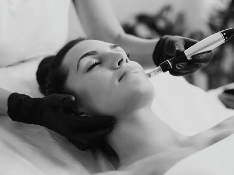 Dermoplasma o Plasma Pen aplicado en Centro EBM Castelldefels