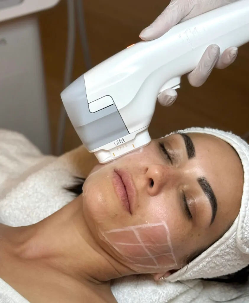 HIFU y aparatología estética de última generación en Castelldefels