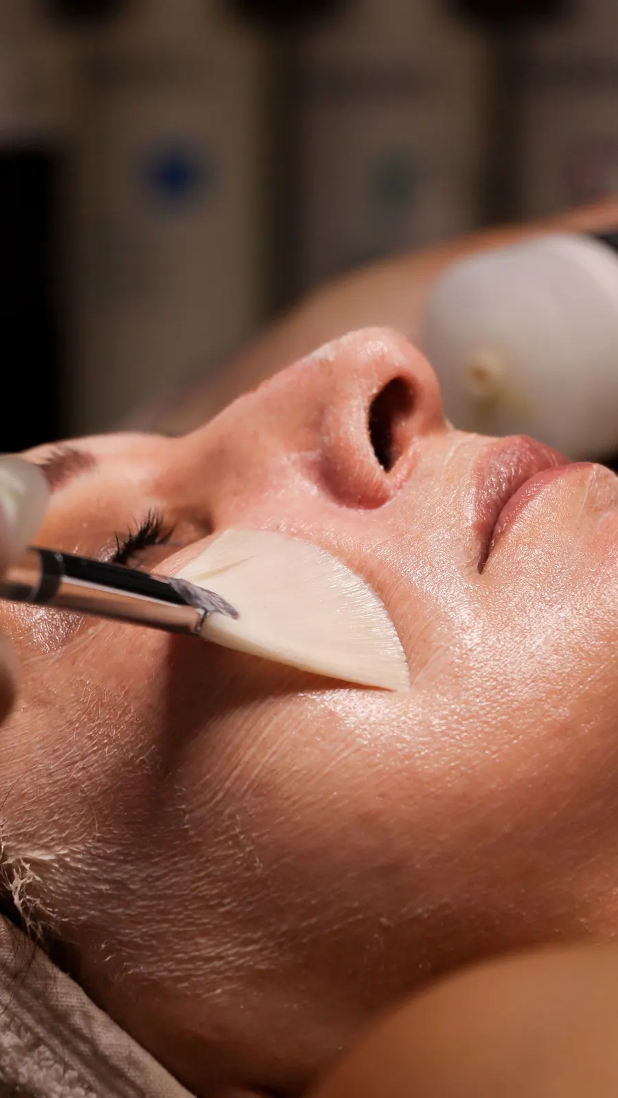 Aplicación de un peeling con ácidos con pincel de abanico