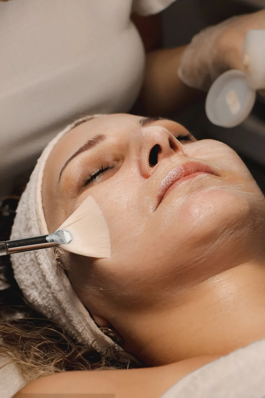 Peeling químico intensivo aplicado en cabina